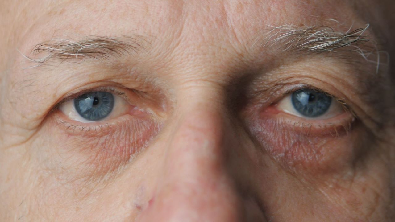 Thủy tinh thể thay thế cho mắt người già